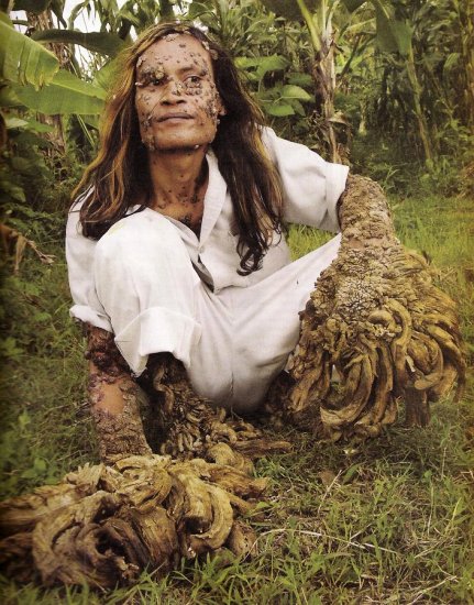 Half man, half tree — that viral forum photo